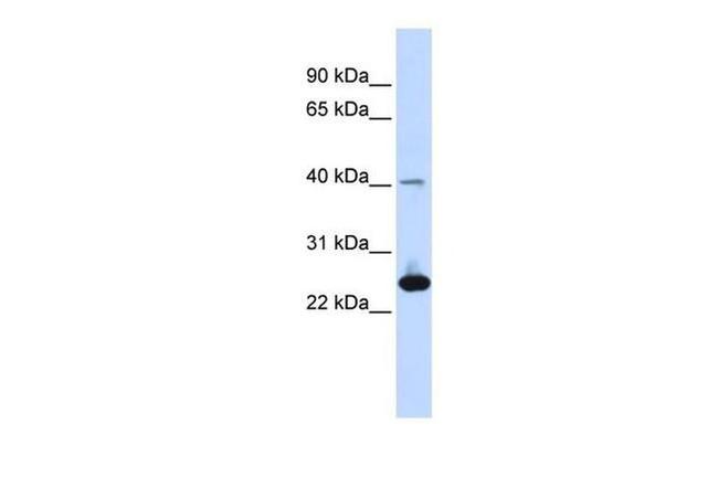 SELS Antibody in Western Blot (WB)