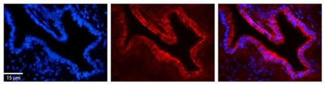 UMPS Antibody in Immunohistochemistry (Paraffin) (IHC (P))