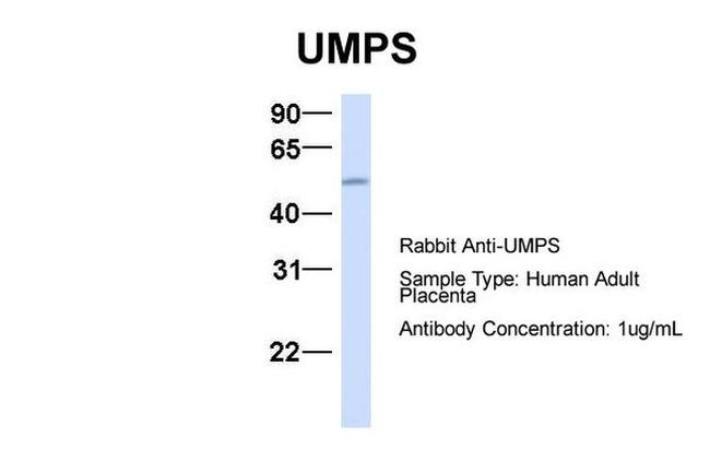 UMPS Antibody in Western Blot (WB)