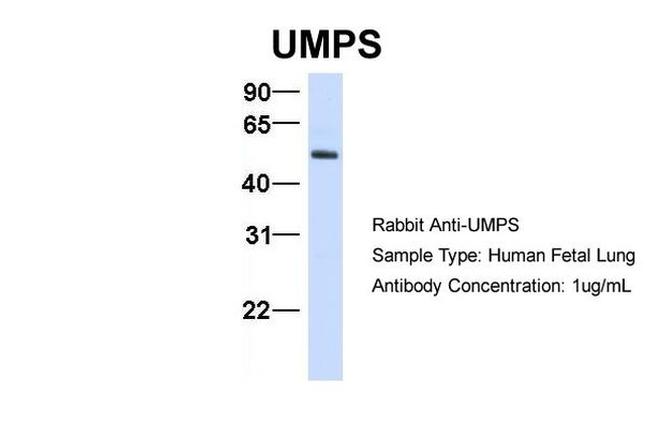 UMPS Antibody in Western Blot (WB)