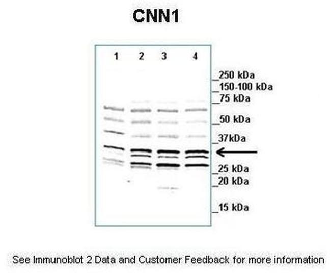 Calponin 1 Antibody in Western Blot (WB)