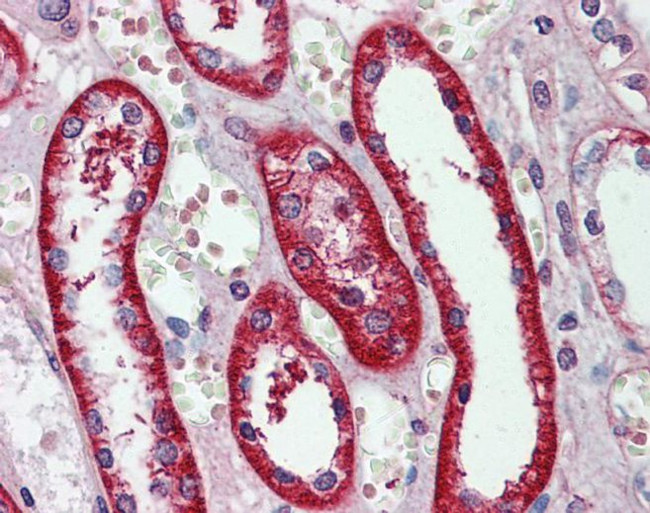 eIF3e Antibody in Immunohistochemistry (IHC)