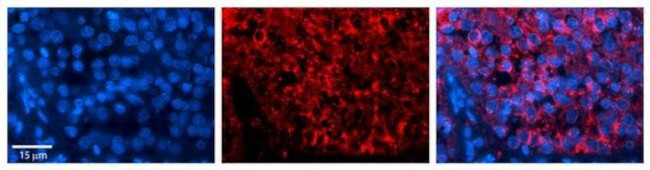 SH3BGRL Antibody in Immunohistochemistry (Paraffin) (IHC (P))