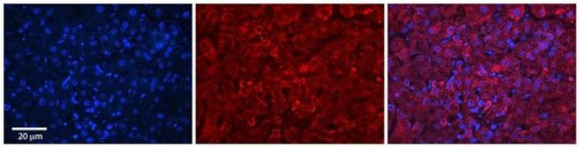 GRHPR Antibody in Immunohistochemistry (Paraffin) (IHC (P))