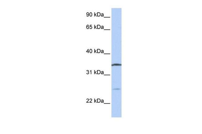 OCIAD1 Antibody in Western Blot (WB)