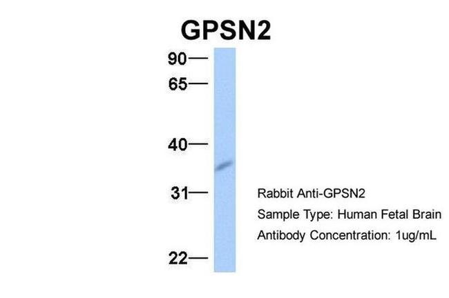 GPSN2 Antibody in Western Blot (WB)