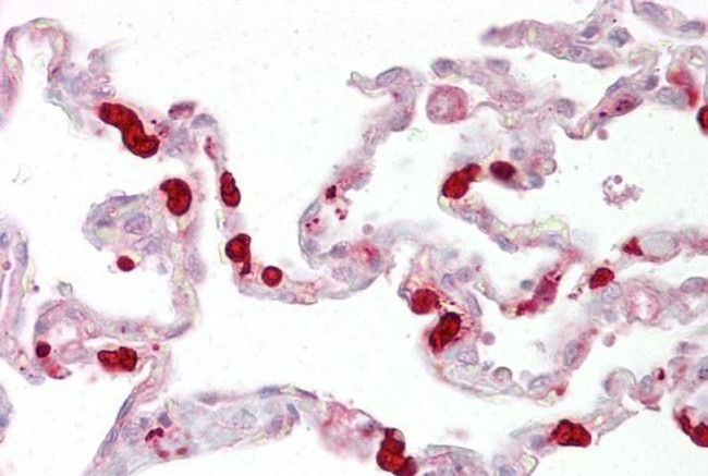 GSTT1 Antibody in Immunohistochemistry (IHC)