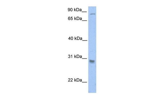 GSTT1 Antibody in Western Blot (WB)