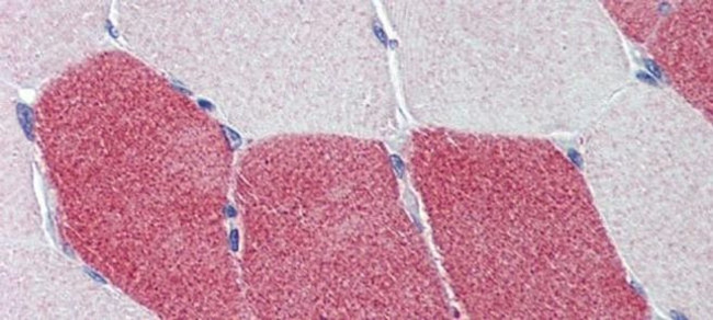 HMGCS1 Antibody in Immunohistochemistry (IHC)