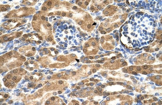 SDF2 Antibody in Immunohistochemistry (IHC)