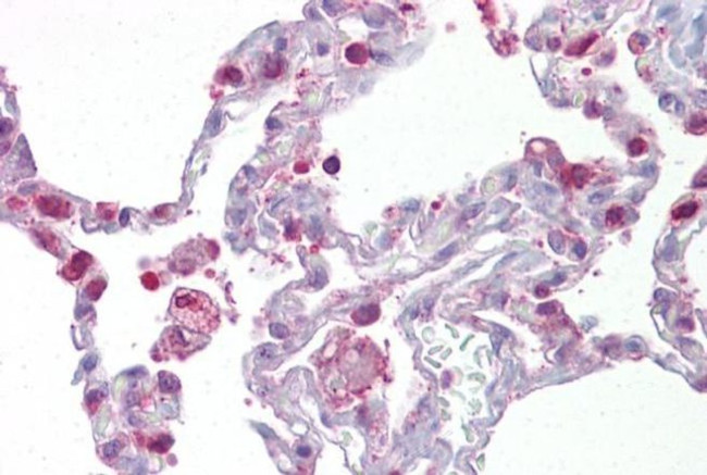 HPGDS Antibody in Immunohistochemistry (IHC)