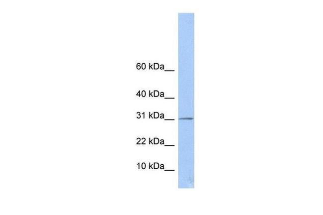 ECHDC1 Antibody in Western Blot (WB)