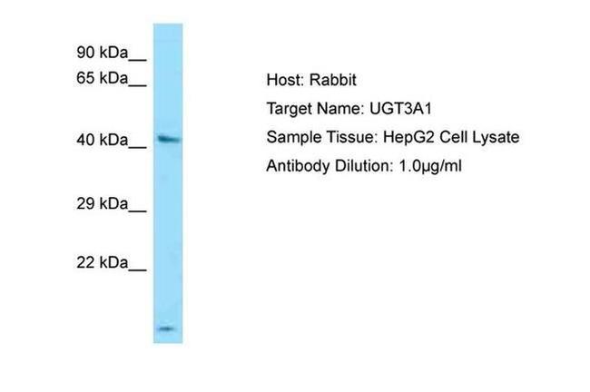 UGT3A1 Antibody in Western Blot (WB)