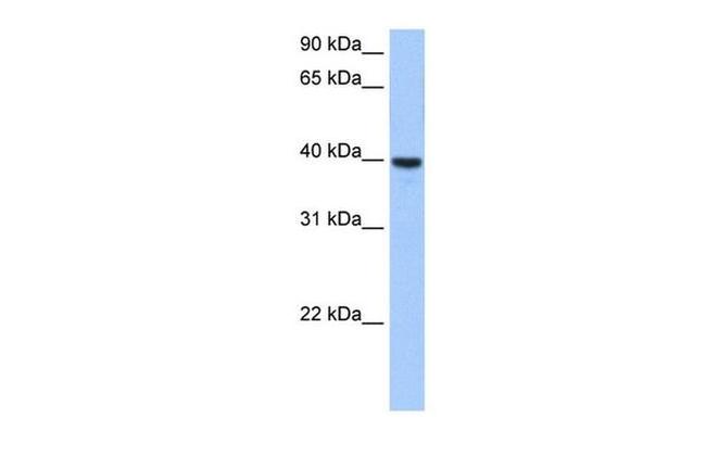 ST6GALNAC4 Antibody in Western Blot (WB)