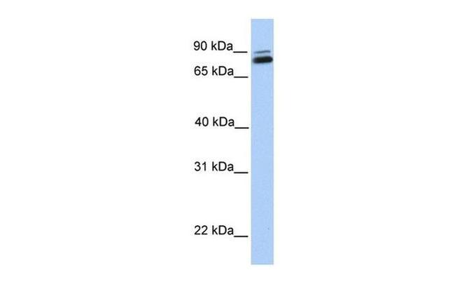 GGT7 Antibody in Western Blot (WB)