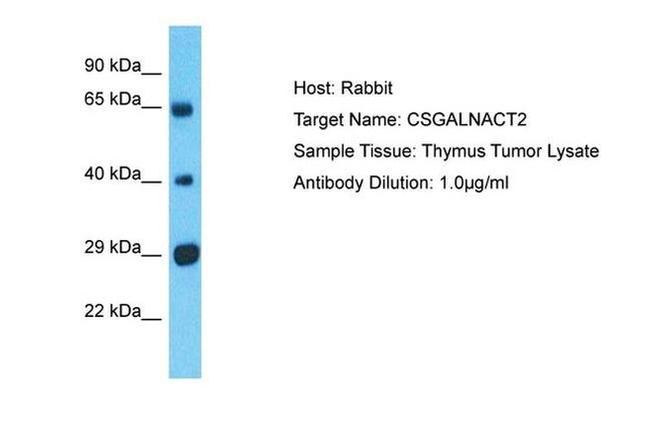 CSGALNACT2 Antibody in Western Blot (WB)