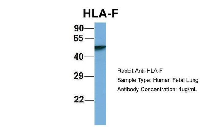 HLA-F Antibody in Western Blot (WB)