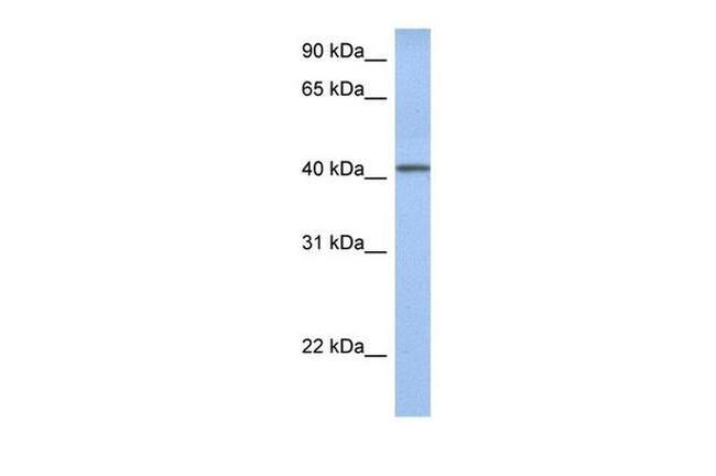 YIPF1 Antibody in Western Blot (WB)