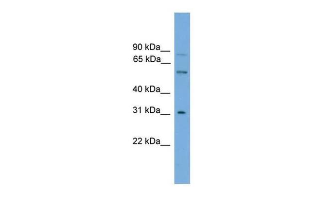 UGT1A5 Antibody in Western Blot (WB)