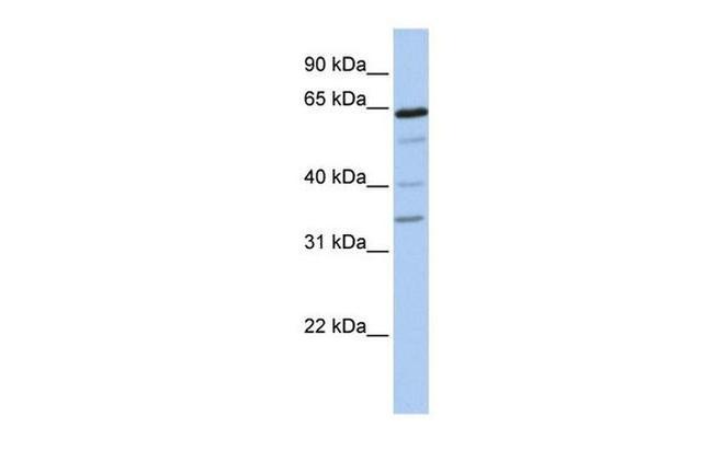 GALNT16 Antibody in Western Blot (WB)