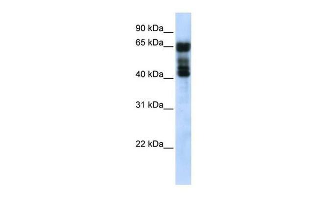 UGT2B4 Antibody in Western Blot (WB)