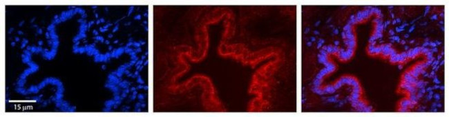 SRPRB Antibody in Immunohistochemistry (Paraffin) (IHC (P))