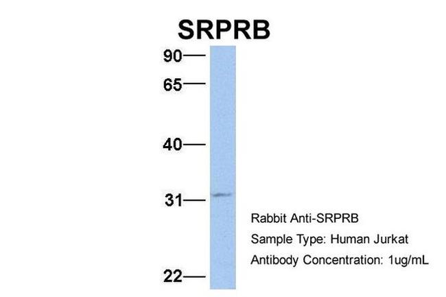 SRPRB Antibody in Western Blot (WB)