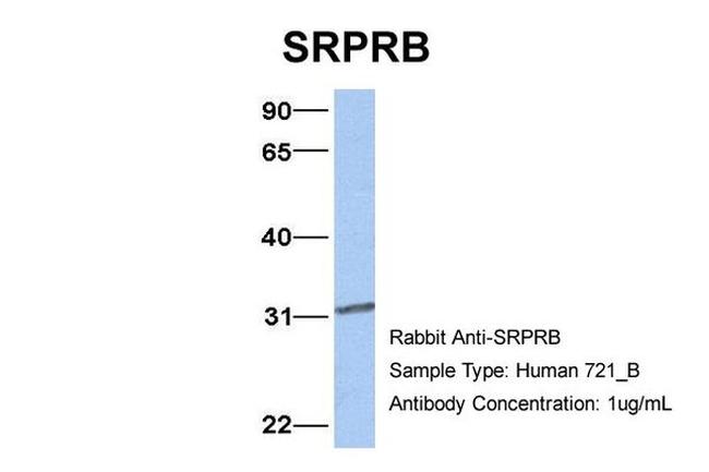 SRPRB Antibody in Western Blot (WB)