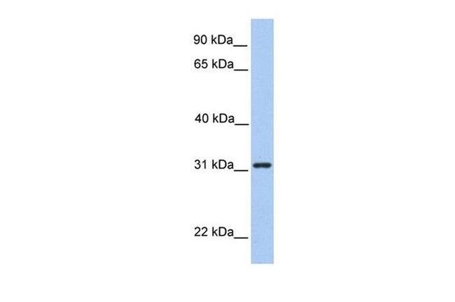 SRPRB Antibody in Western Blot (WB)