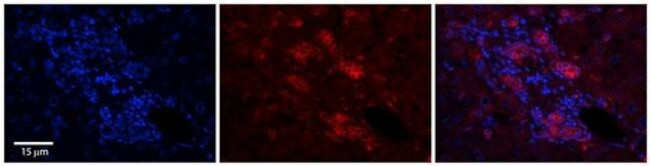 C11orf24 Antibody in Immunohistochemistry (Paraffin) (IHC (P))