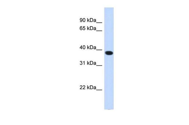 ACBD4 Antibody in Western Blot (WB)