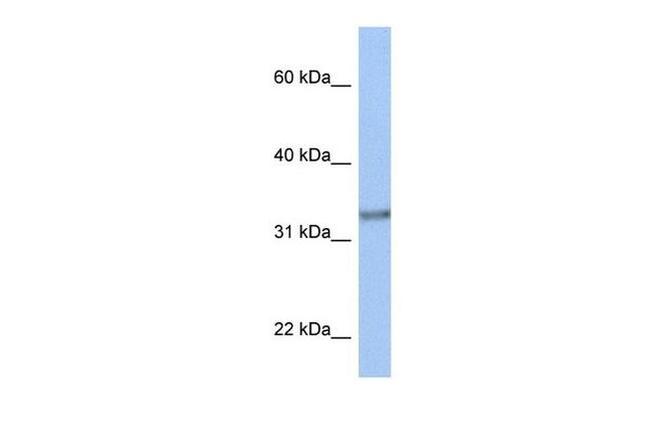 ACBD4 Antibody in Western Blot (WB)