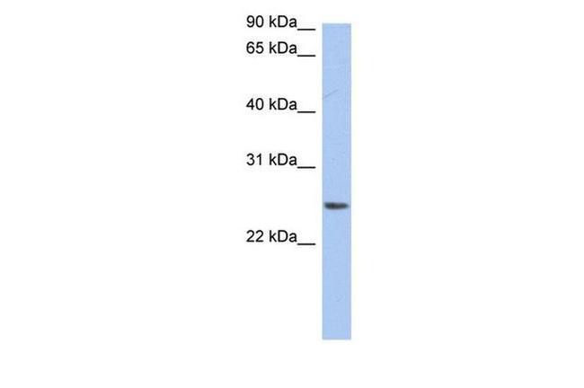 Neurensin 2 Antibody in Western Blot (WB)