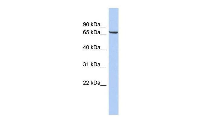 LRRTM4 Antibody in Western Blot (WB)