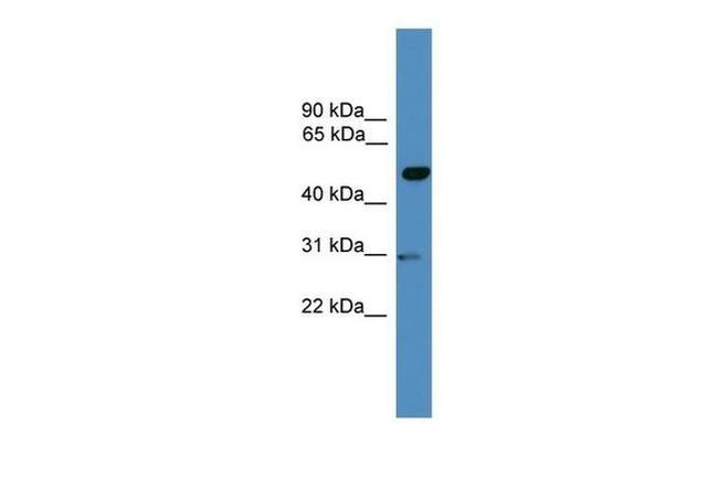 GAL3ST3 Antibody in Western Blot (WB)