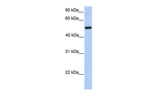 GALNT13 Antibody in Western Blot (WB)