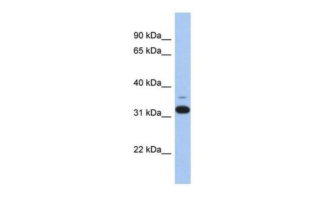 CMG2 Antibody in Western Blot (WB)