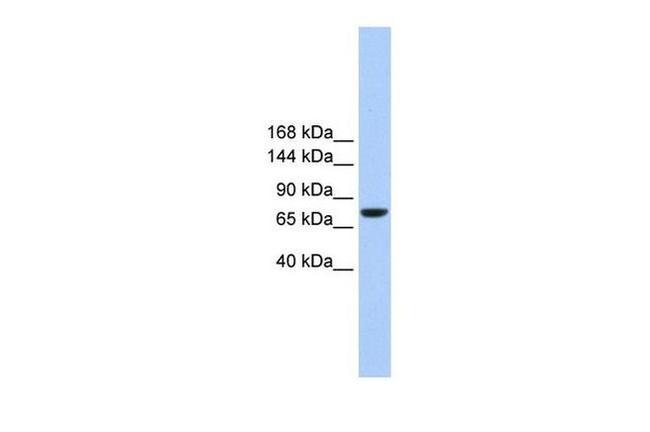 TMC2 Antibody in Western Blot (WB)