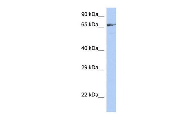 ZNF676 Antibody in Western Blot (WB)