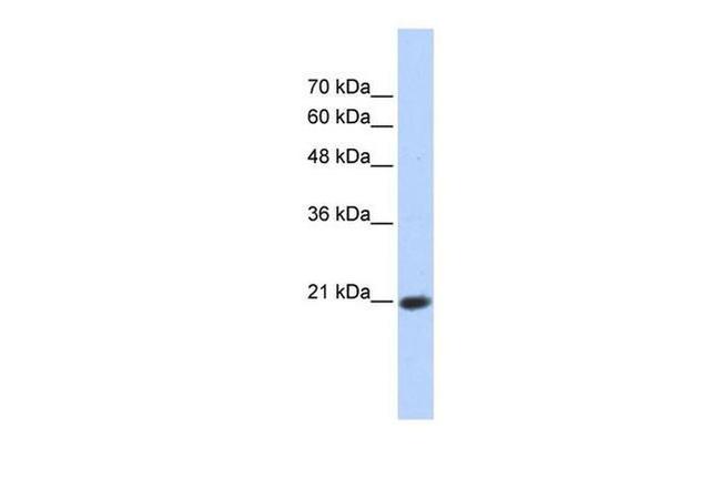 TCEAL8 Antibody in Western Blot (WB)