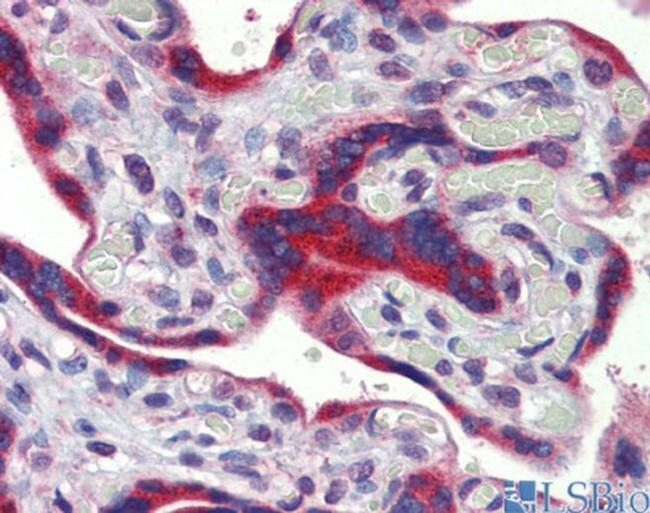 FEZF1 Antibody in Immunohistochemistry (IHC)