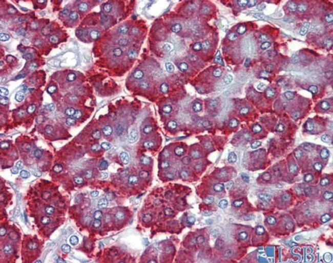 FEZF1 Antibody in Immunohistochemistry (IHC)