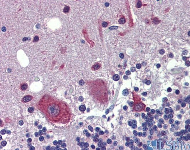 FEZF1 Antibody in Immunohistochemistry (IHC)