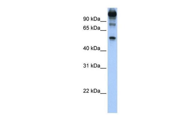 FEZF1 Antibody in Western Blot (WB)