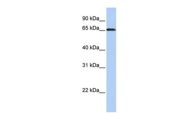 ZXDC Antibody in Western Blot (WB)