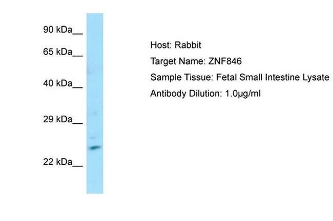 ZNF846 Antibody in Western Blot (WB)