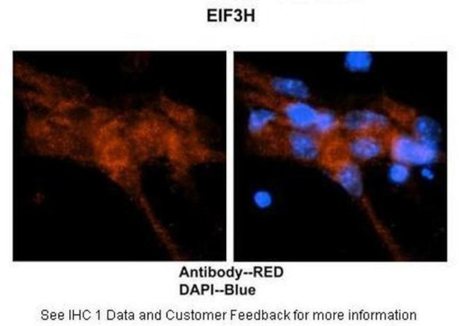 eIF3h Antibody in Immunohistochemistry (IHC)
