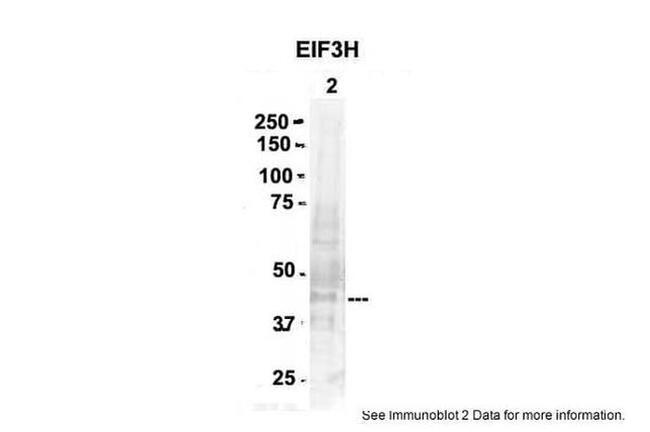 eIF3h Antibody in Western Blot (WB)