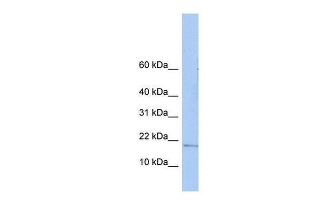 ZNHIT3 Antibody in Western Blot (WB)