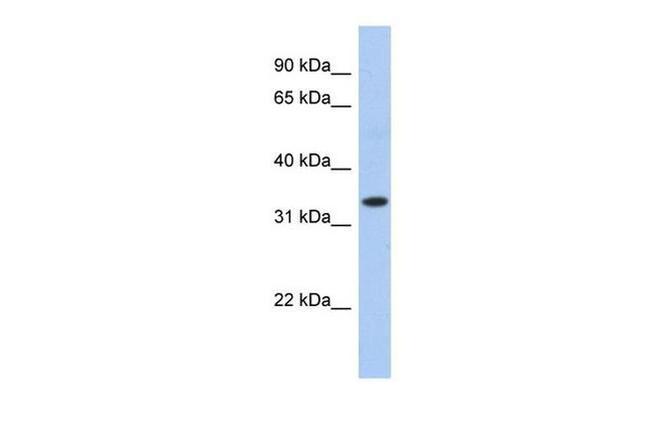 SPRY1 Antibody in Western Blot (WB)